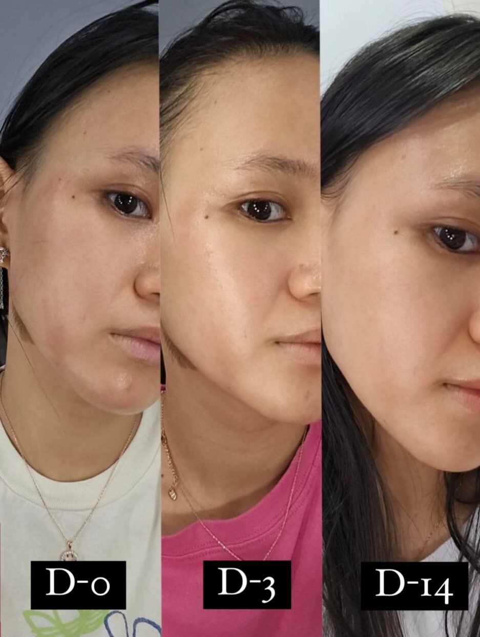 Before After - ElishaCoy Face Mist Vegan Kombucha